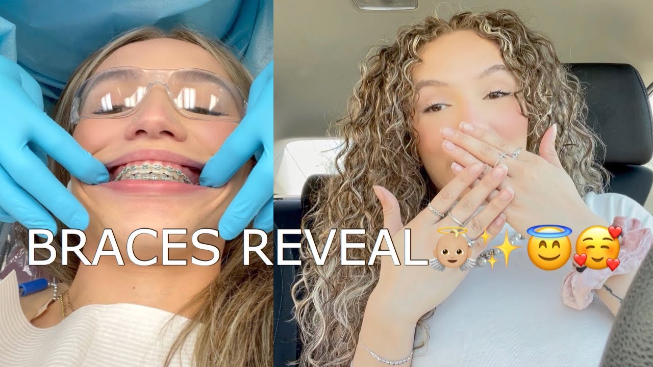 GETTING MY BRACES OFF!!! COME W ME♡