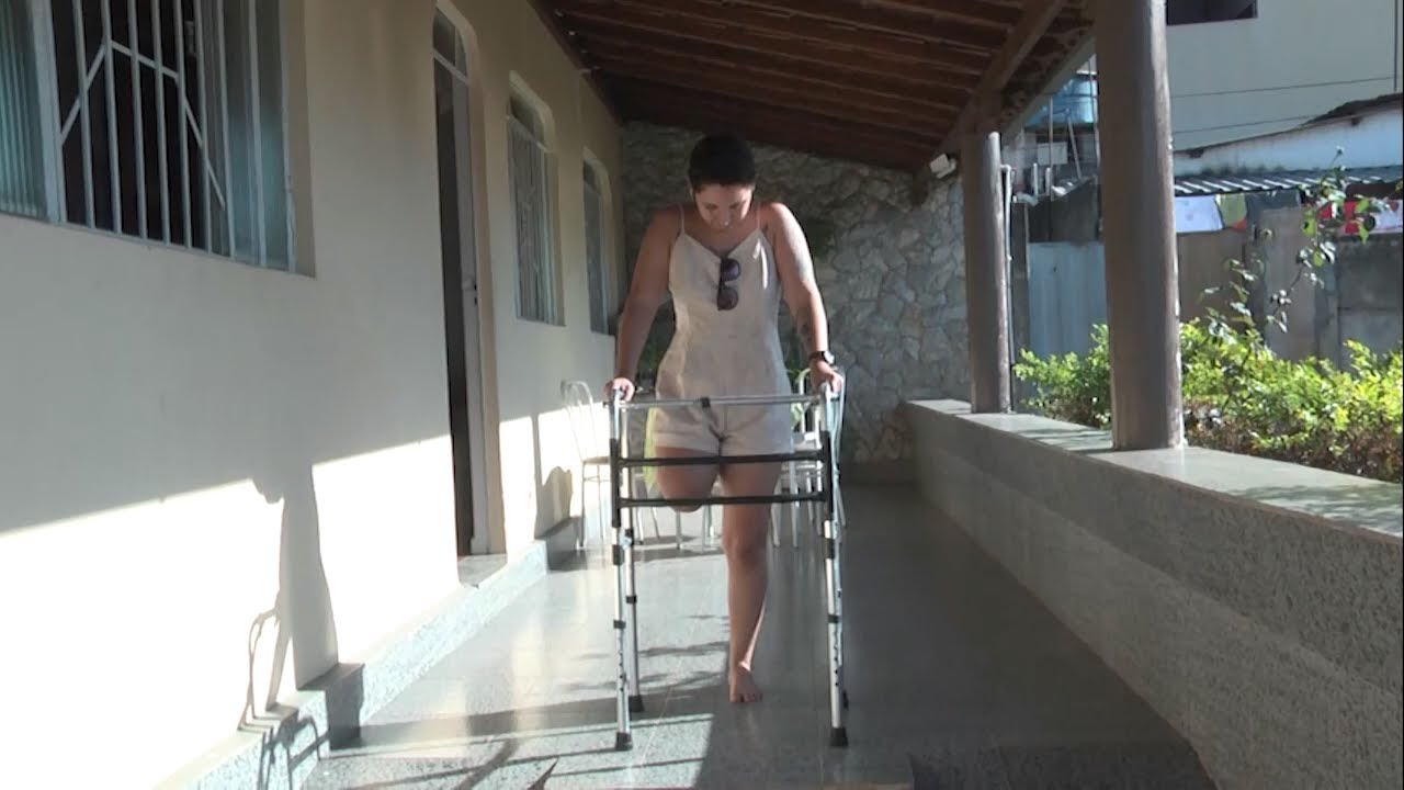 Jovem tem a perna amputada após levar tiro e busca ajuda para implantar prótese