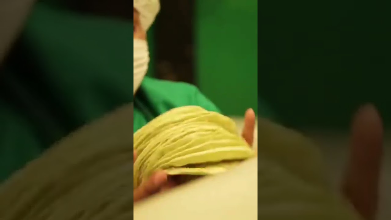 AMAZING NOPAL CACTUS 🌵 PROCESSING #shorts #youtubeshorts