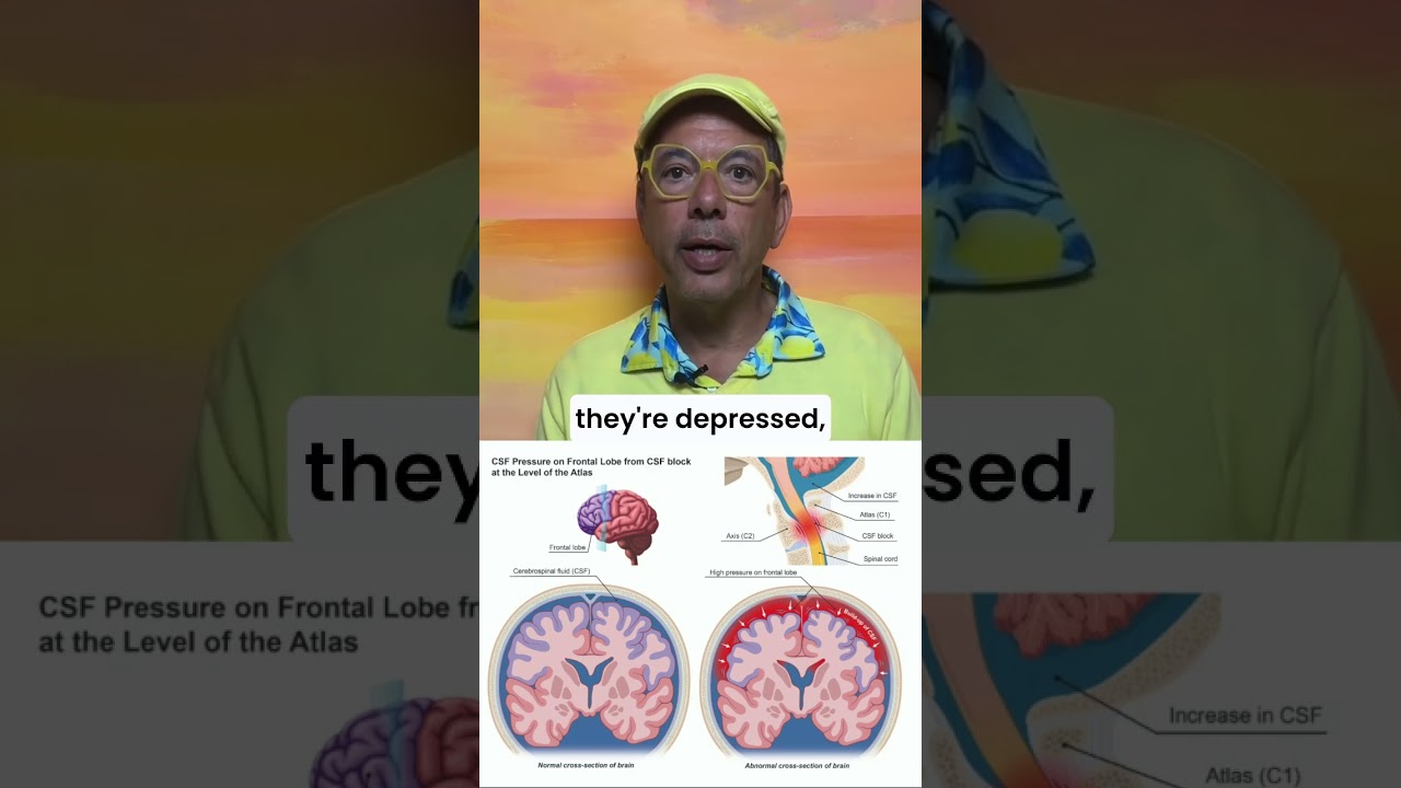 Frontal lobe dysfunction affects personality, and may be from the neck #lookingup #brain #mental
