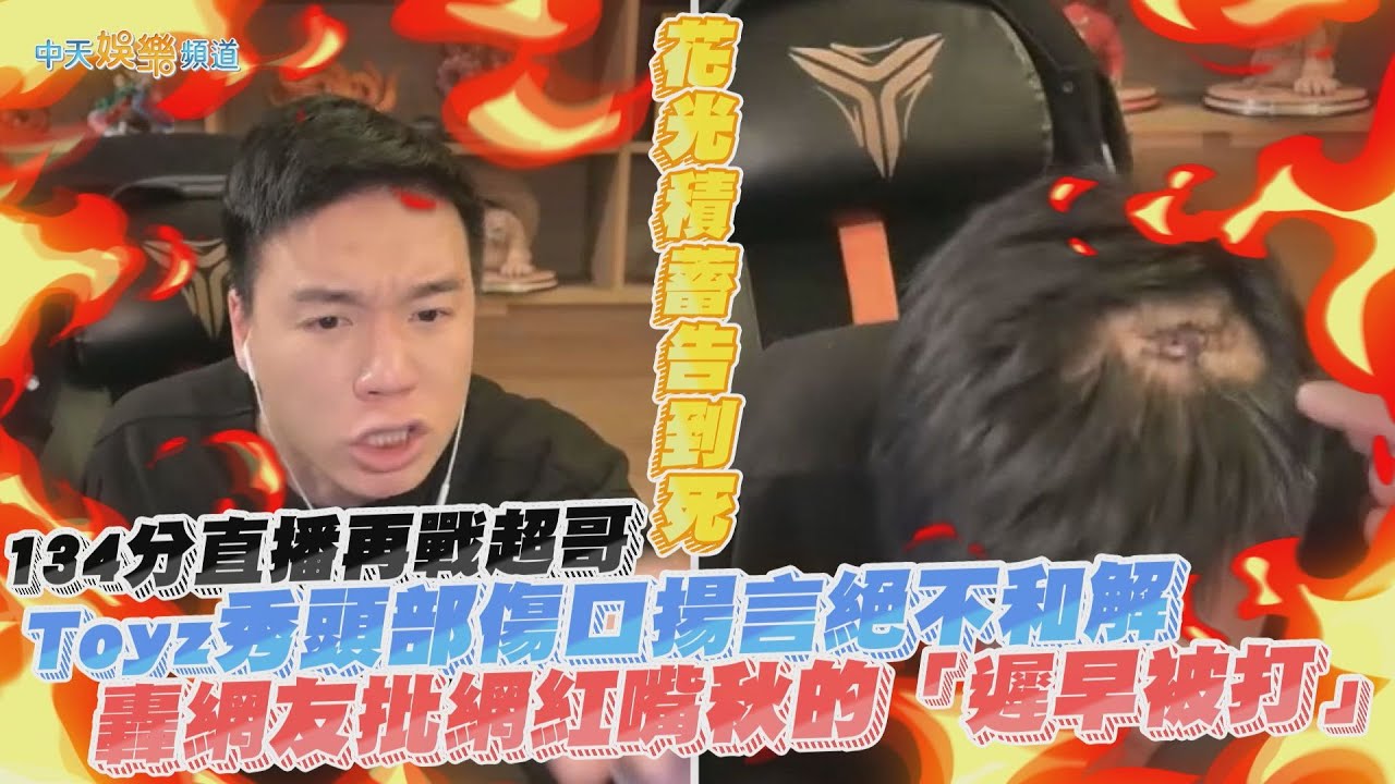 【撩星聞】134分直播再戰超哥~Toyz秀頭部傷口揚言絕不和解「花光積蓄告到死」 轟網友批網紅嘴秋的「遲早被打」