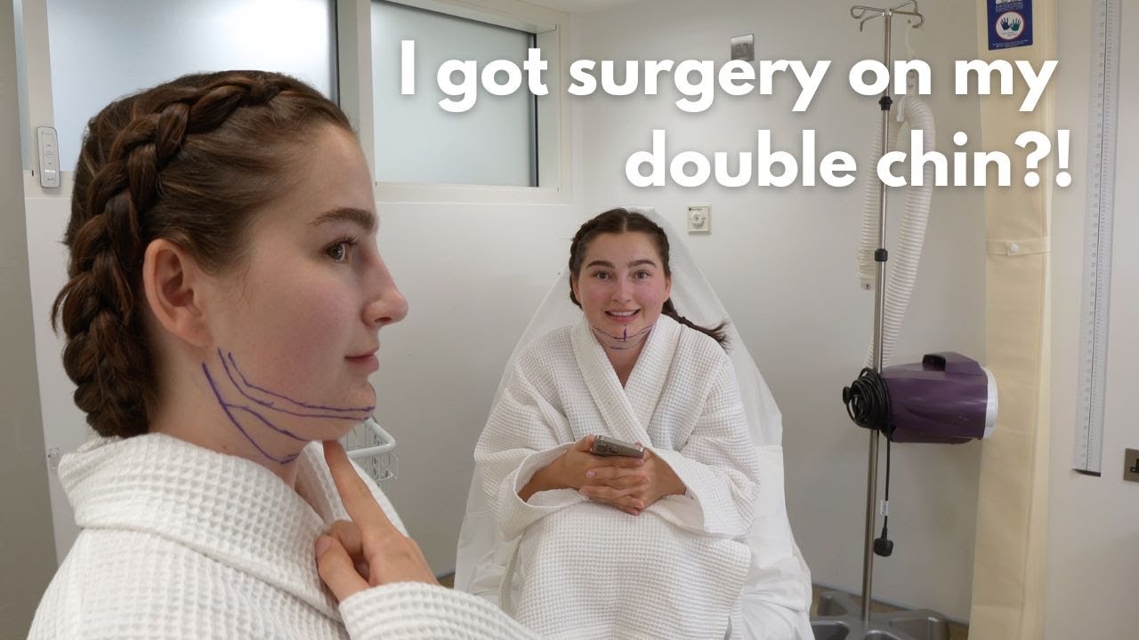 I GOT MY DOUBLE CHIN REMOVED?! surgery vlog...