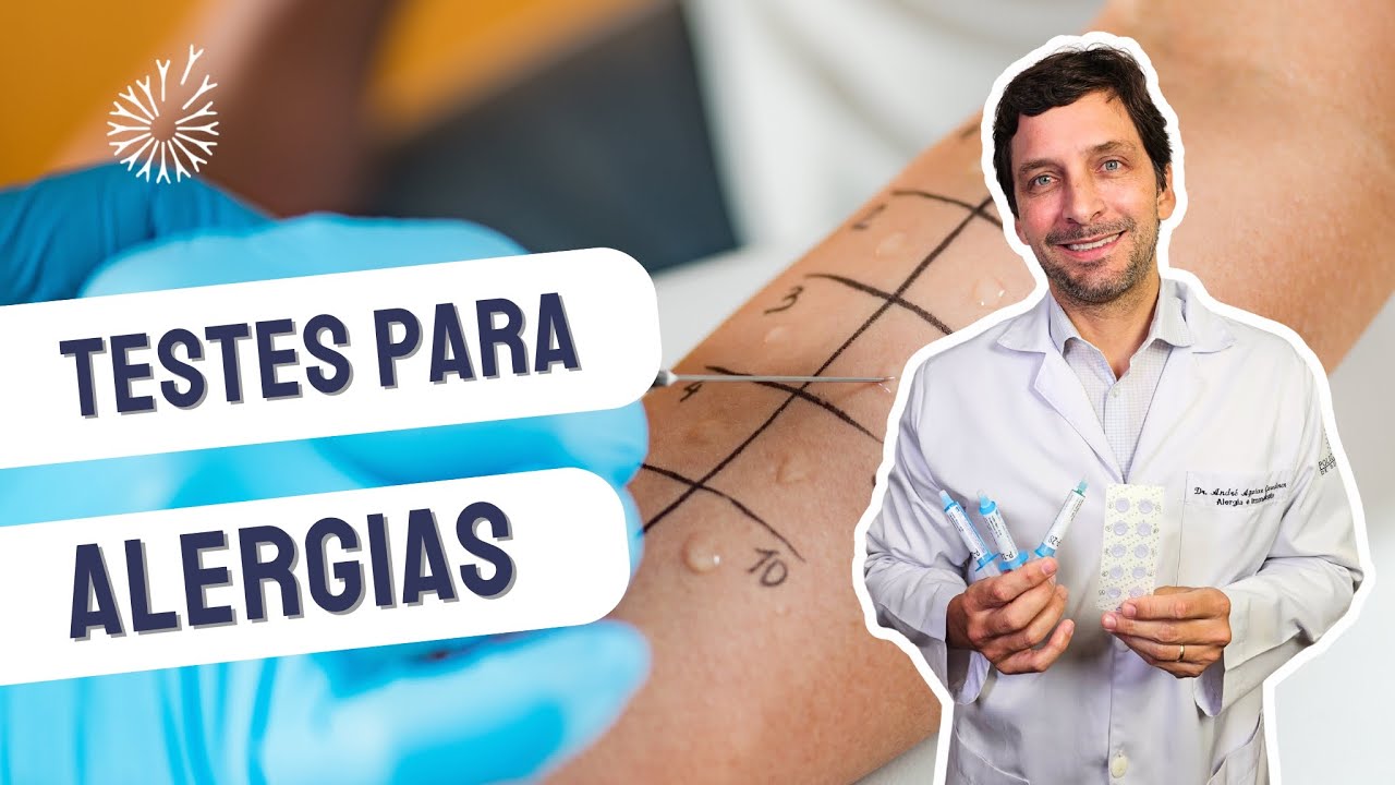 TESTES PARA ALERGIAS | #alergias #dermatite  #alergista