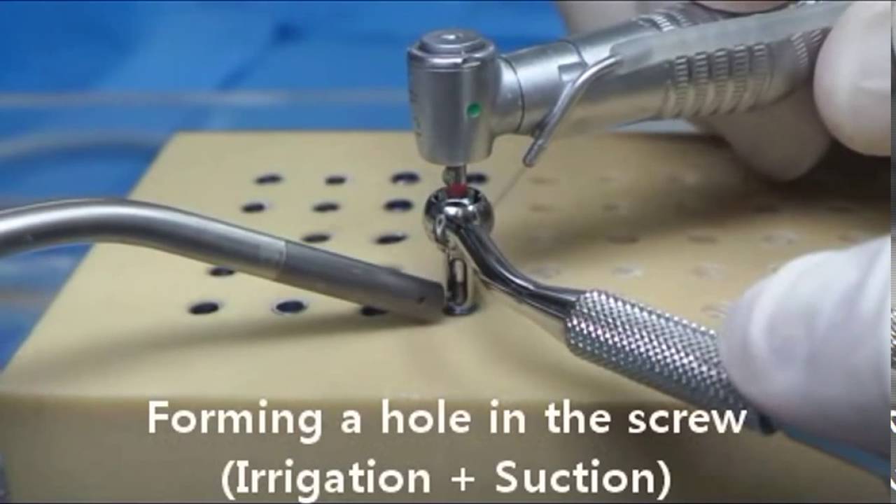 ESR KIT - SR Tip - Used To Remove Fractured Screw