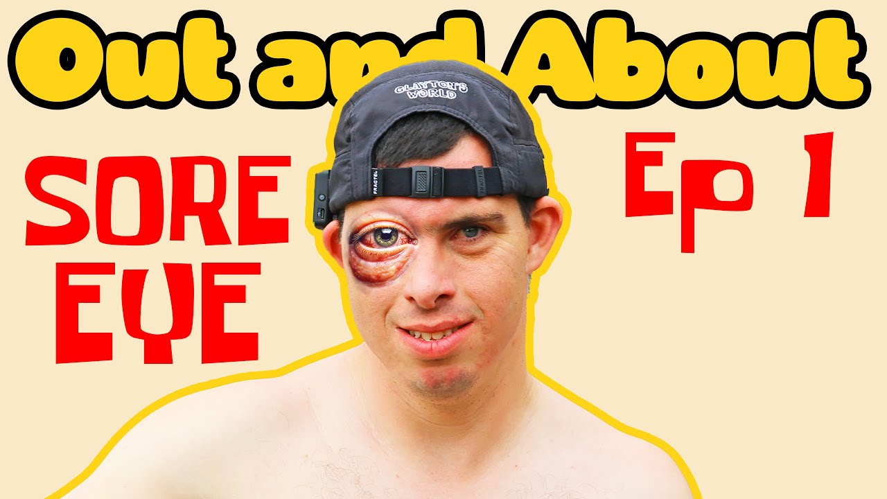 OUT AND ABOUT EP1 - Yours and owls festival Day 1 “sore eye”