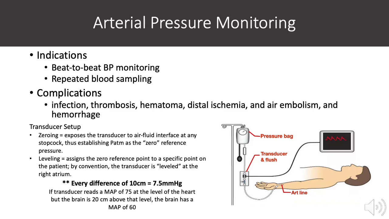 Standard Monitors in the ICU
