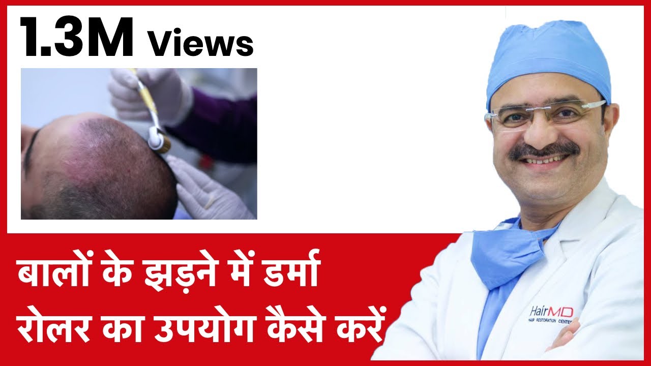 How to Use Dermaroller for Hair Loss(बालों के झड़ने में Dermaroller का उपयोग कैसे करें) | (In HINDI)
