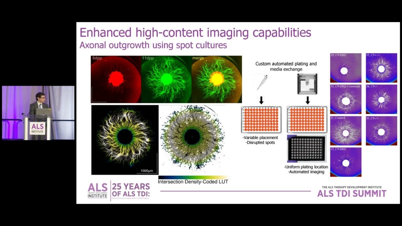 HUMAN CELL BIOLOGY RESEARCH AT ALS TDI with Kyle Denton