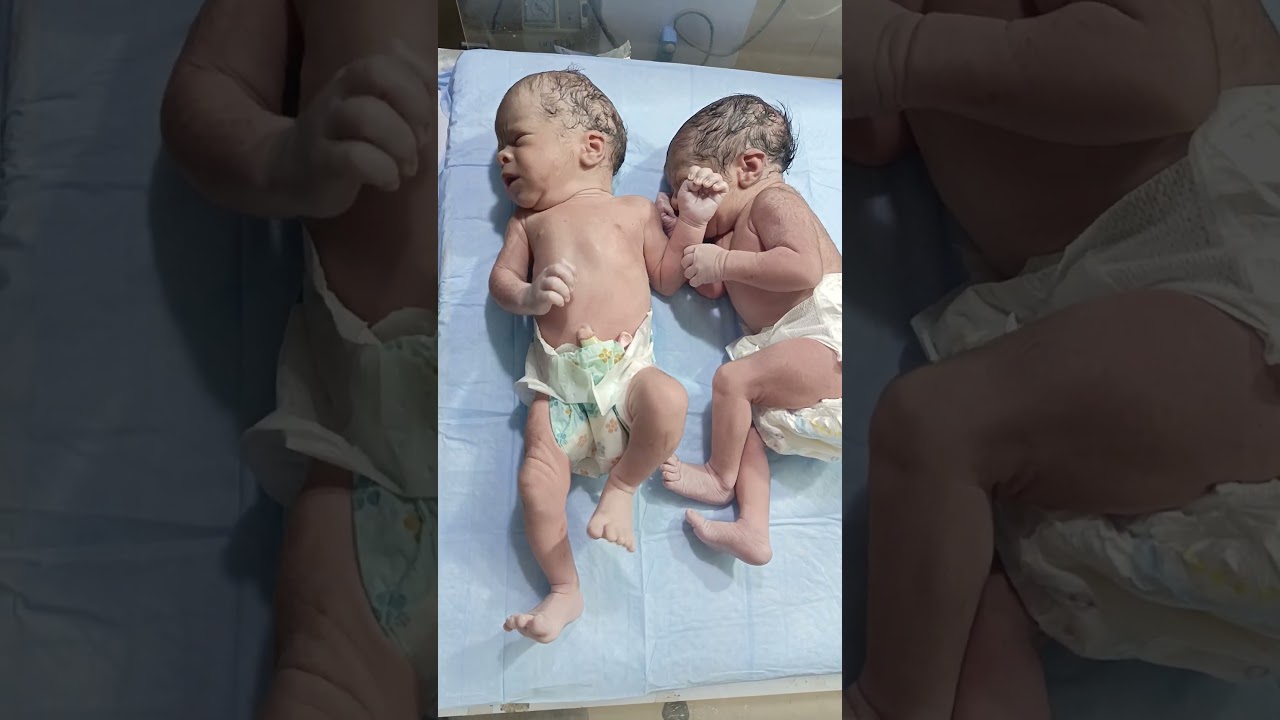 received two little twins 🐥🐥 with all their normal reflexes 💕😘