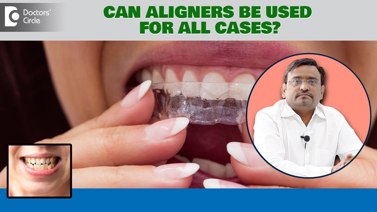 Clear Aligners vs Braces to Straighten Teeth - Which is best? - Dr.Nirmal Raj A P | Doctors' Circle