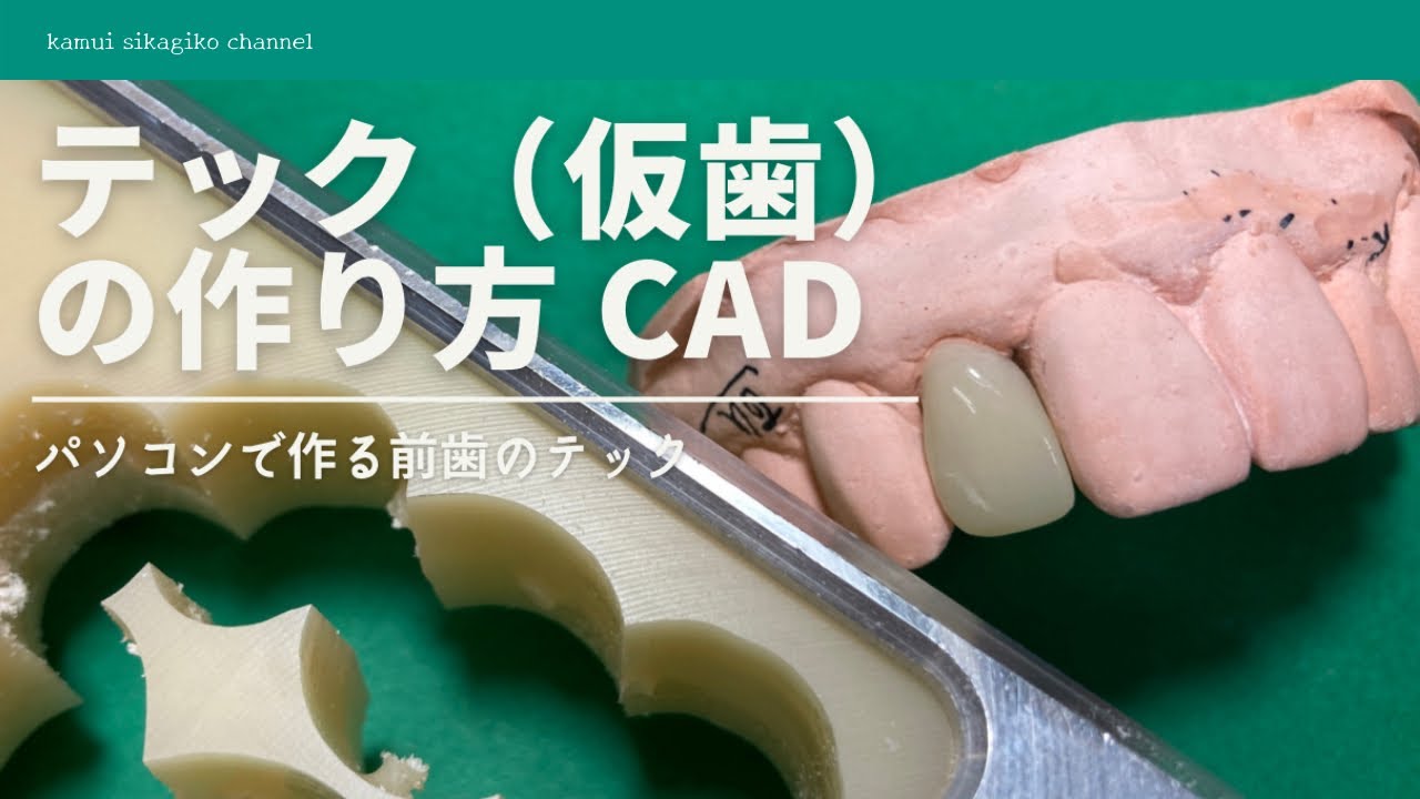 【歯科技工】テック（仮歯）の作り方《CAD／CAMシステム》