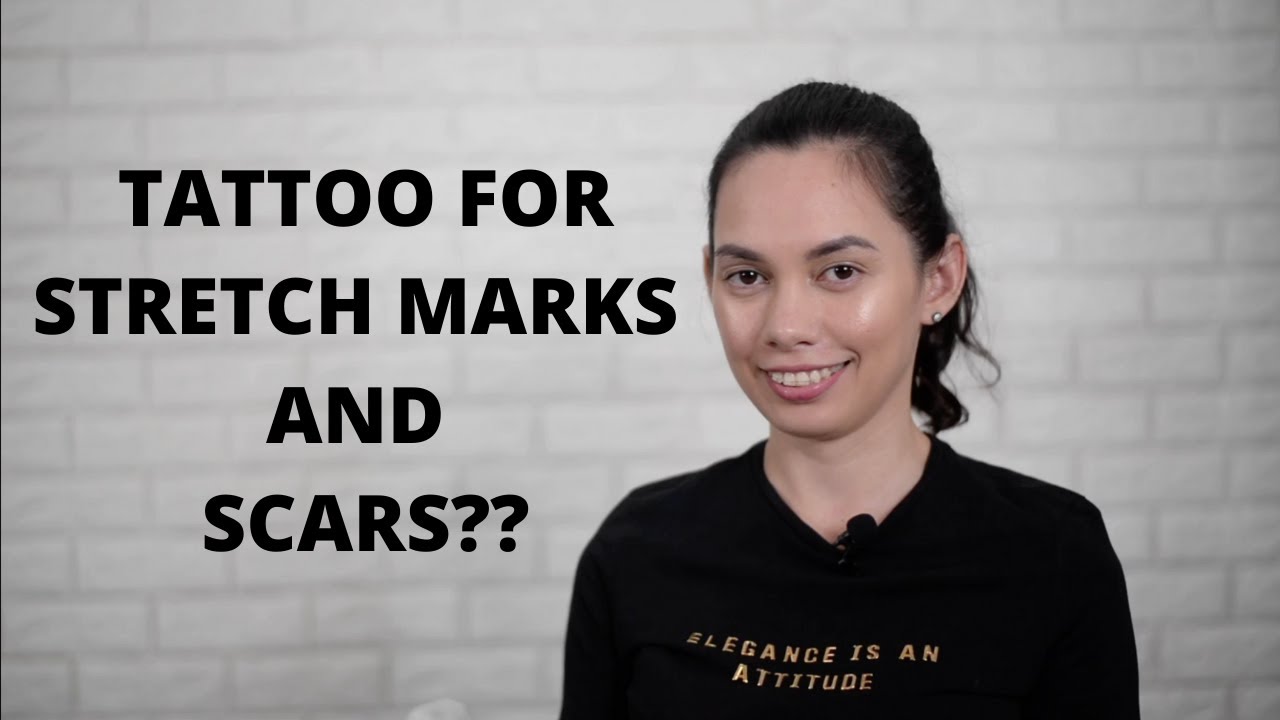 THE PROVEN MOST EFFECTIVE WAY TO PERMANENTLY CONCEAL STRETCH MARKS AND SCARS.