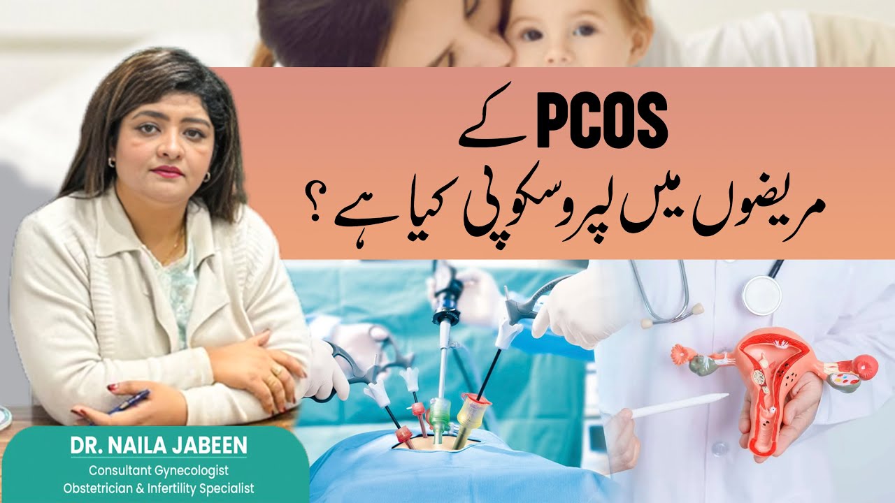 Laparoscopy for PCOS: Understanding the Procedure and Benefits | Dr. Naila Jabeen