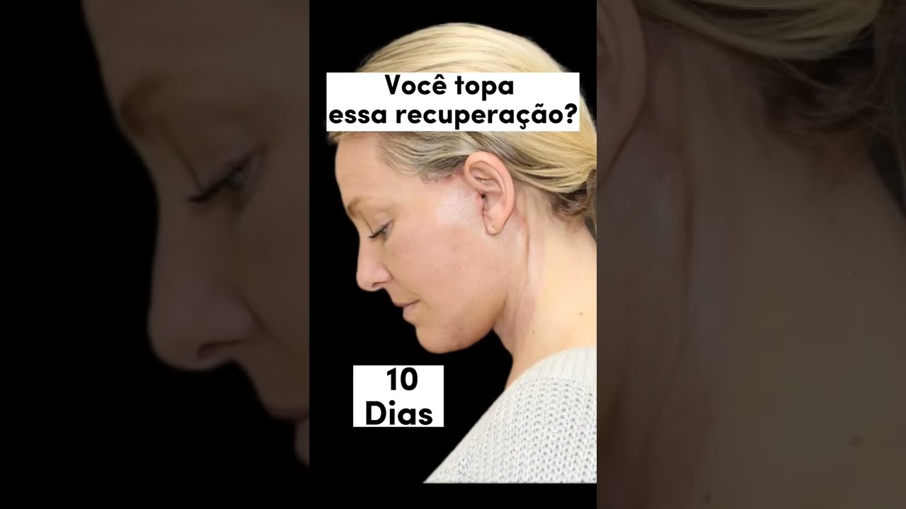 Você toparia!?  