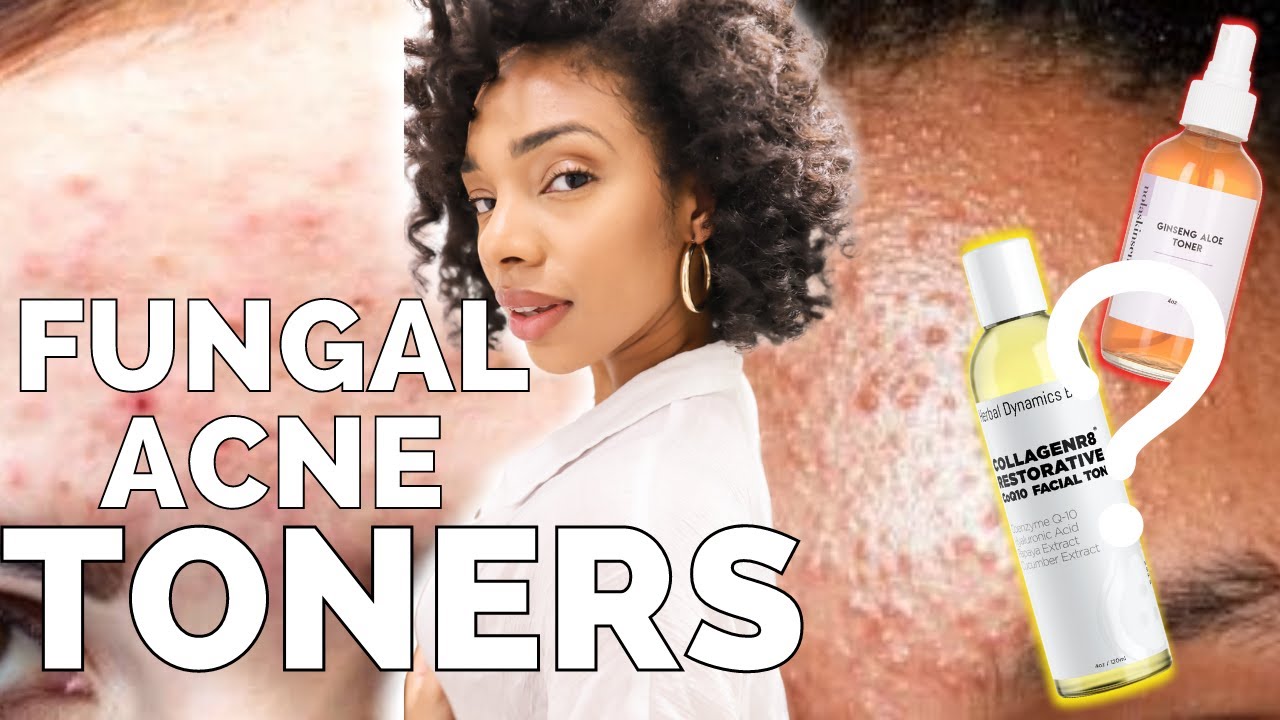 The BEST Toners | Fungal Acne Safe ( exfoliating, hydrating, & anti aging )