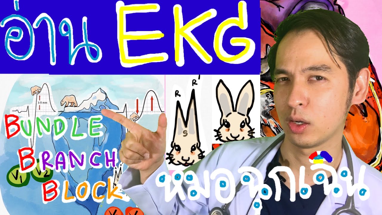 อ่าน EKG ง่ายนิดเดียว Bundle Branch Block