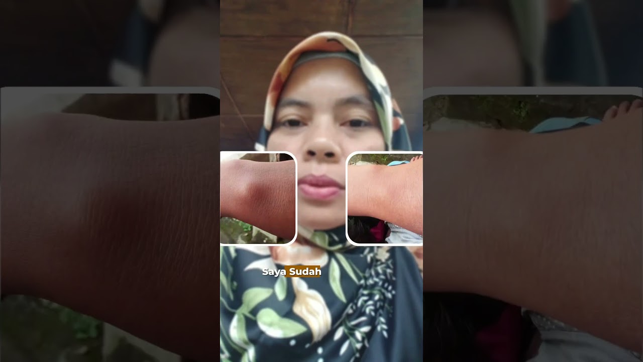 Bantu Kempeskan Benjolan Secara Alami #healingoil #qahira