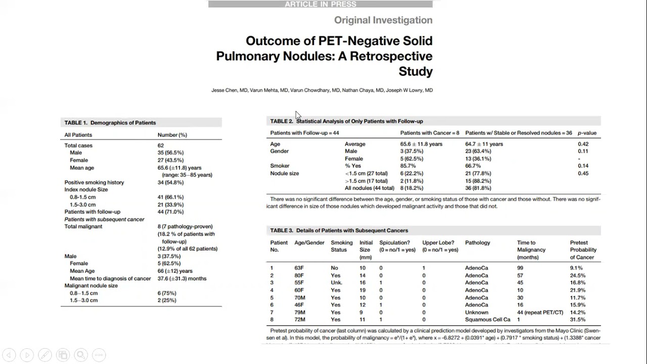 PET/CT negative pulmonary nodules