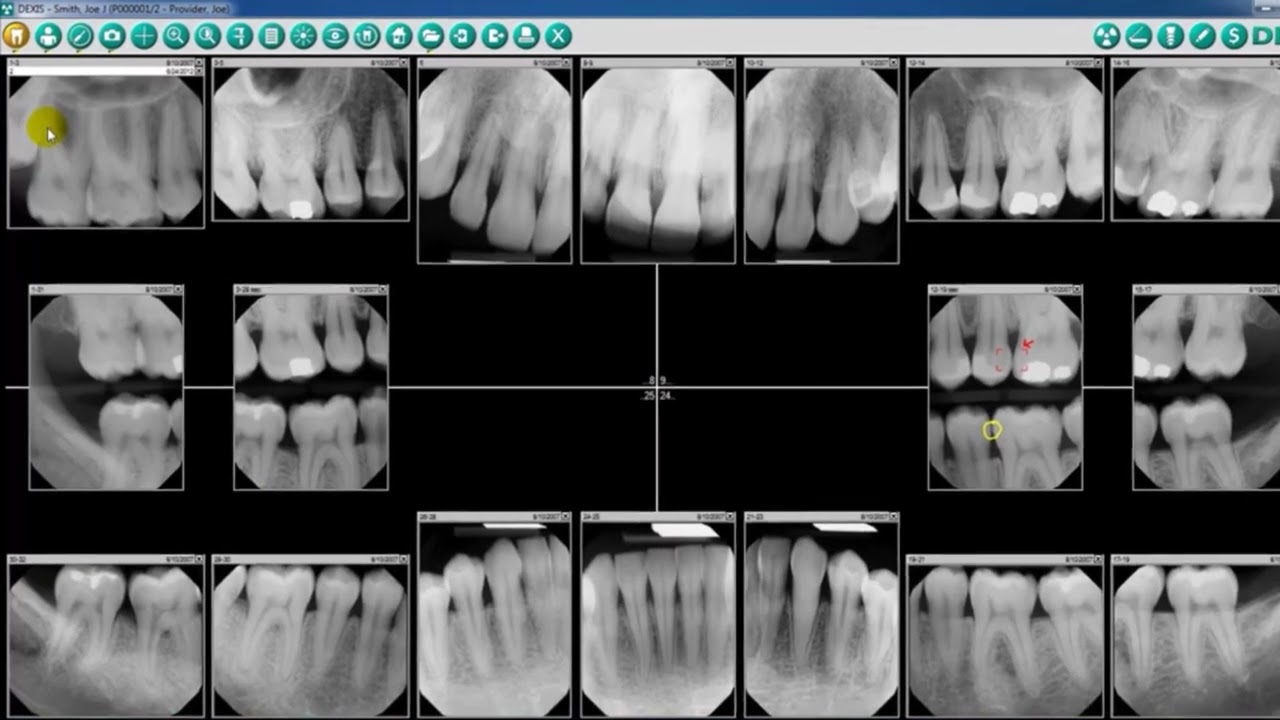 DEXIS Imaging Suite - Patient Screen Overview