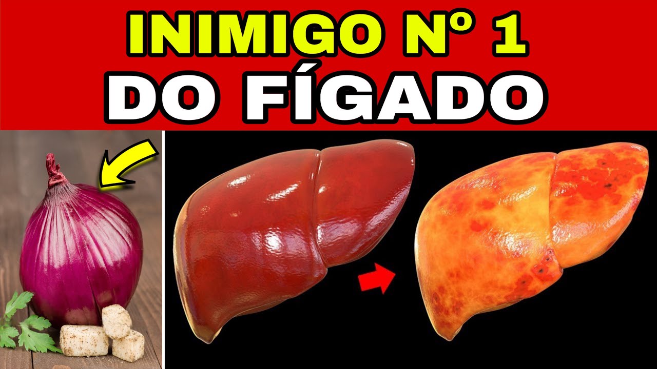 REVELADO! Este alimento DESTRÓI seu FÍGADO (sem você saber)! O Inimigo #1 da Gordura no Fígado