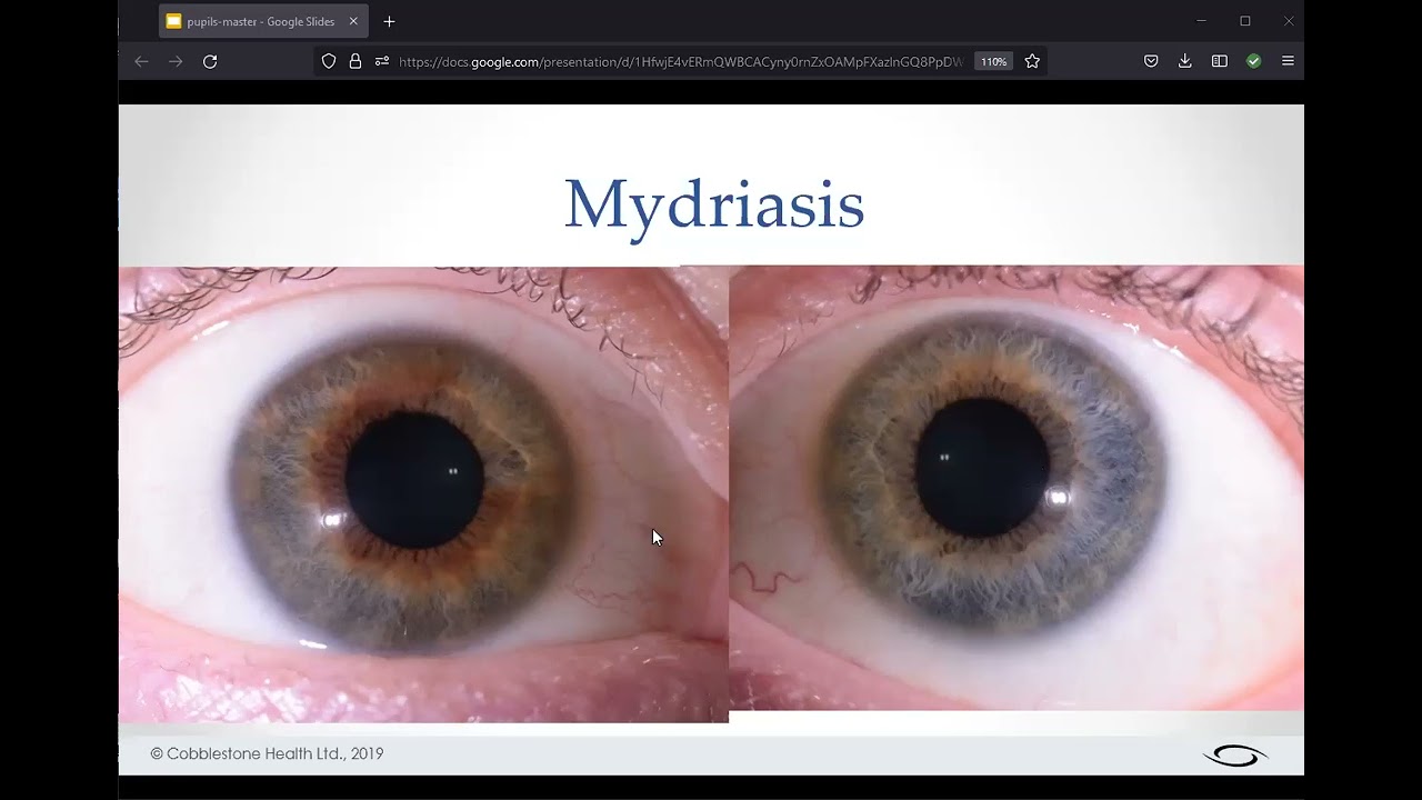 What information does the pupil add to an iris assessment?