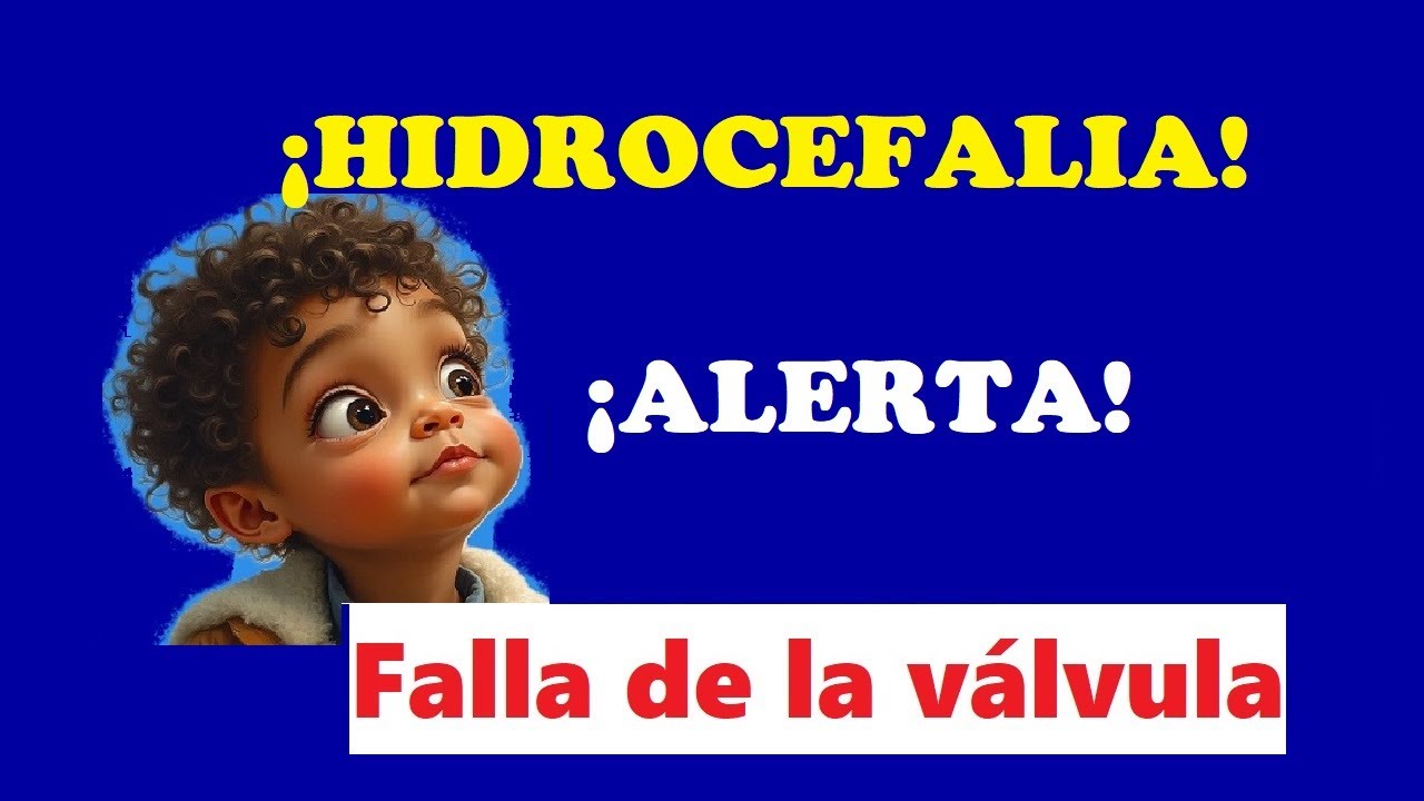 ¿Tienes VÁLVULA para HIDROCEFALIA? CUIDADO con Estas COMPLICACIONES | Dr. Cavero.