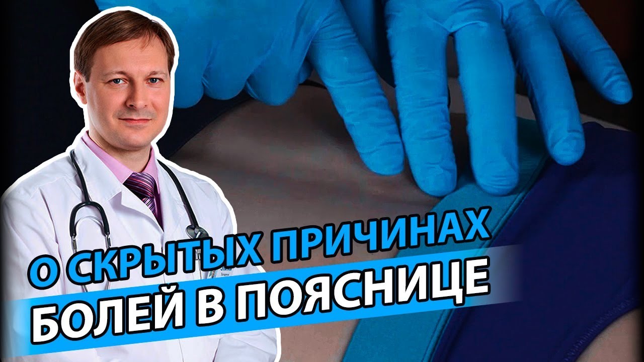 БОЛЬ В ПОЯСНИЦЕ | Маленькая причина большой боли в пояснице