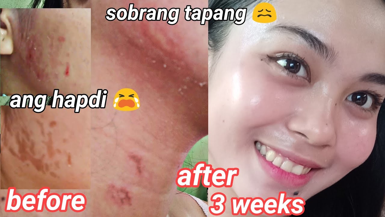 How I cleared my skin? PRESTIGE REJUVENATING SET REVIEW GLASS SKIN ANG PEG 😱