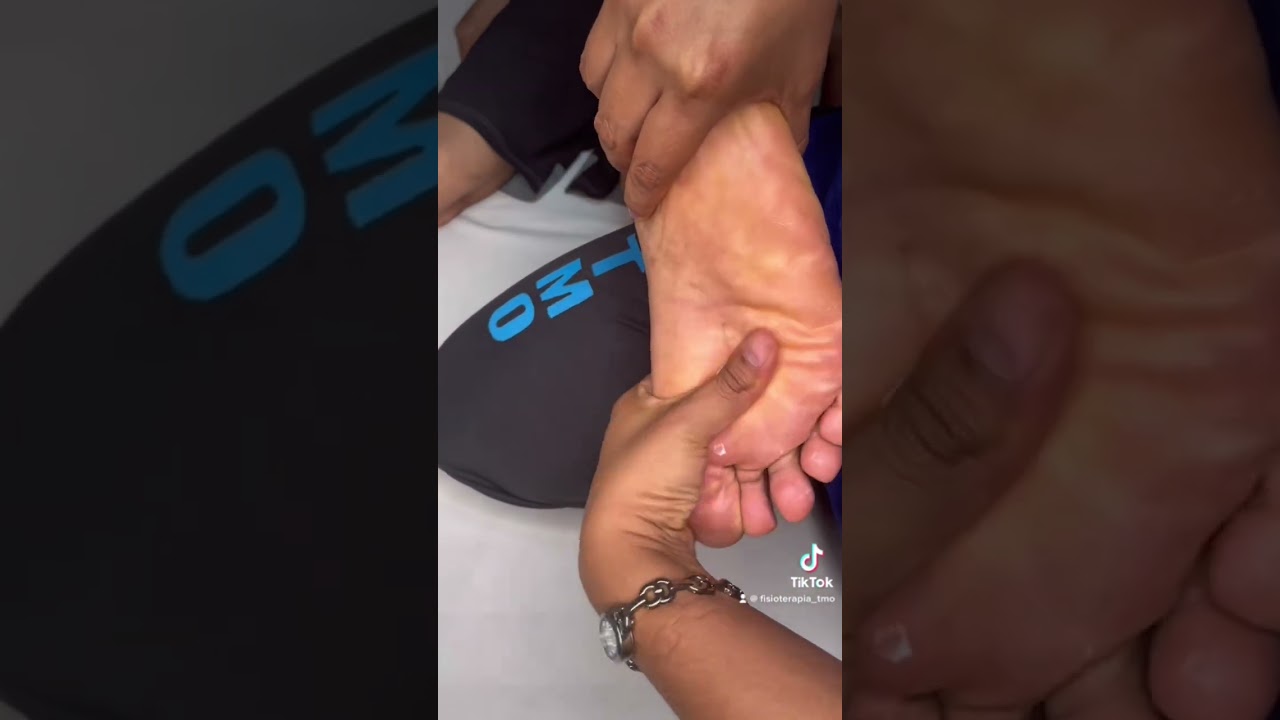 Masaje para una fascitis plantar