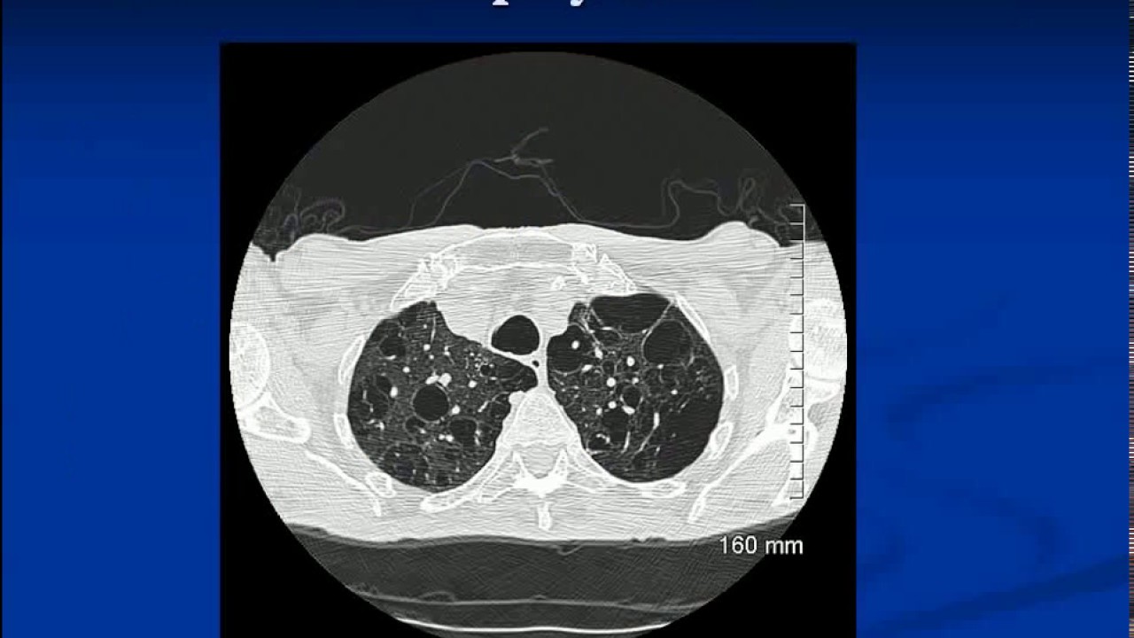 Technology articles. Review of Chest Image Interpretation 2017 (part 3/3)
