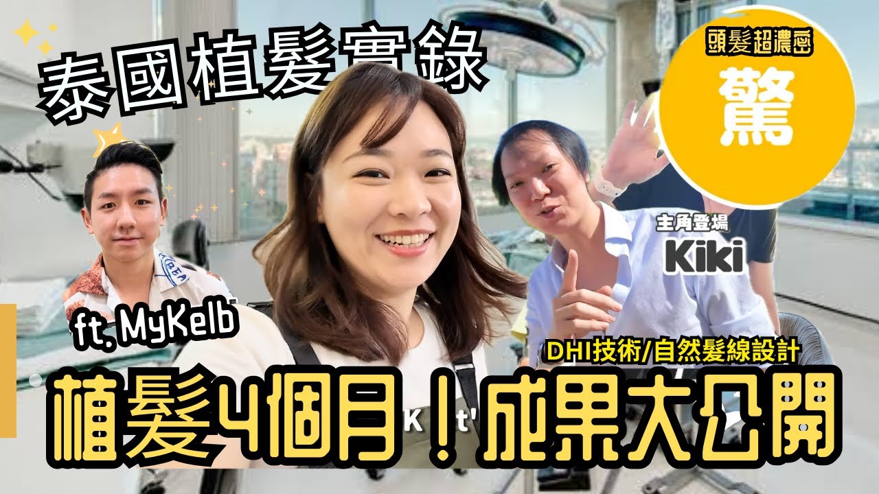 真的在泰國植髮了！？術前到4個月後全紀錄｜髮際線變化太驚人？