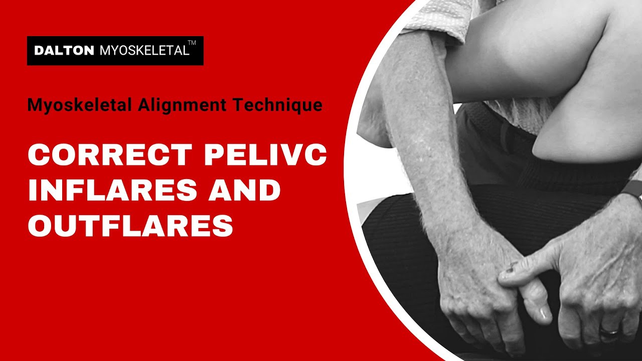 Treating Pelvic Inflare and Outflare with Myoskeletal Alignment Techniques| ErikDalton.com