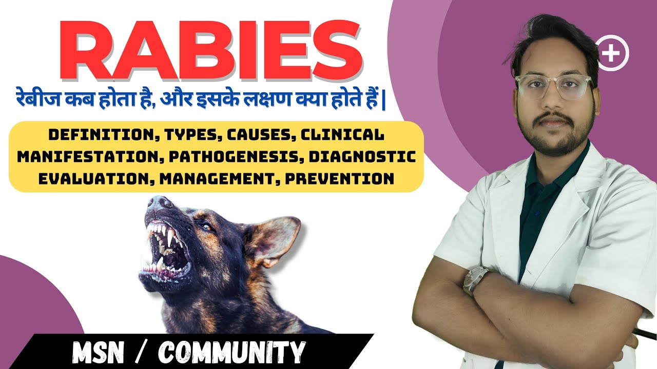 Rabies (Hydrophobia) In Hindi | Symptoms, Causes, Diagnosis, Treatment, Prevention | In Hindi