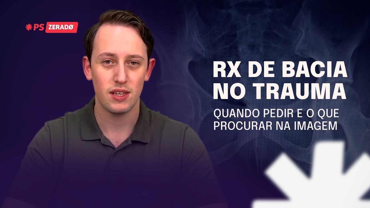 RX DE BACIA/PELVE NO TRAUMA: indicações e interpretação | Dr. Lucas Facio