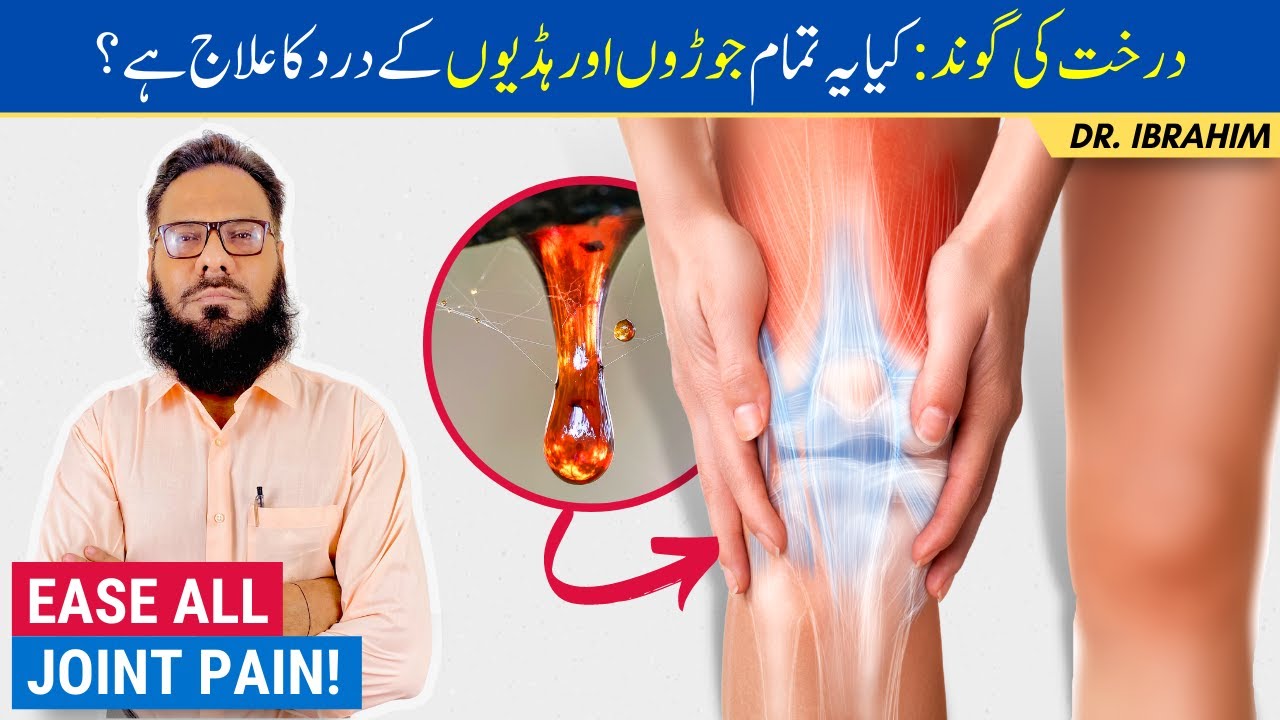 Joron/Haddiyon Ke Dard Ka Ilaj - Darakht Ki Gond Ke Fawaid  - Tree Sap Benefits - Urdu/Hindi
