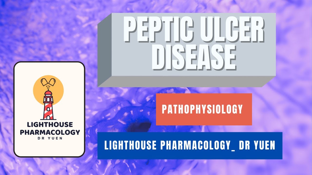 Pathophysiology: Peptic Ulcer Disease (H.pylori + NSAIDs)