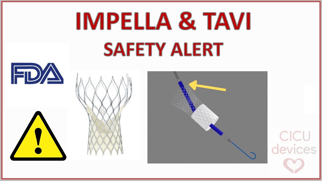 ⚠️ IMPELLA & TAVR OR TAVI INTERACTION - SAFETY TIPS YOU MUST KNOW, SAFETY ALERT 23-07