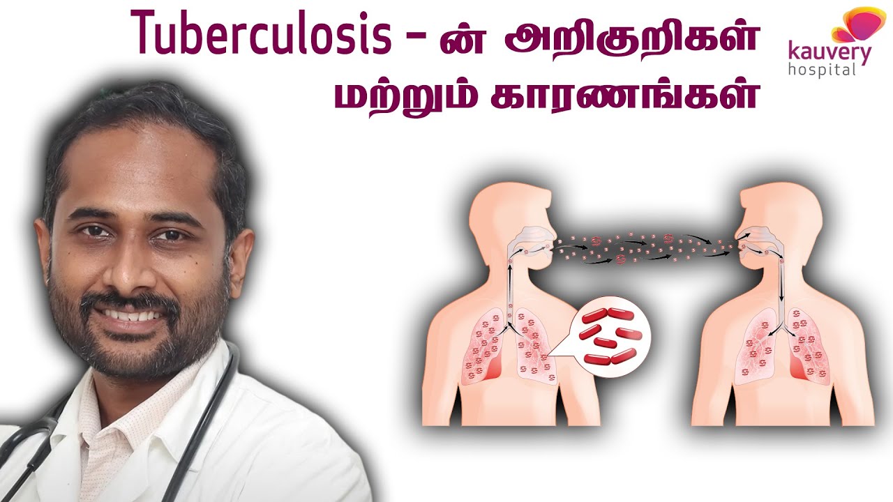 Tuberculosis &ndash; Symptoms and causes | காசநோயின் அறிகுறிகள் மற்றும் காரணங்கள்