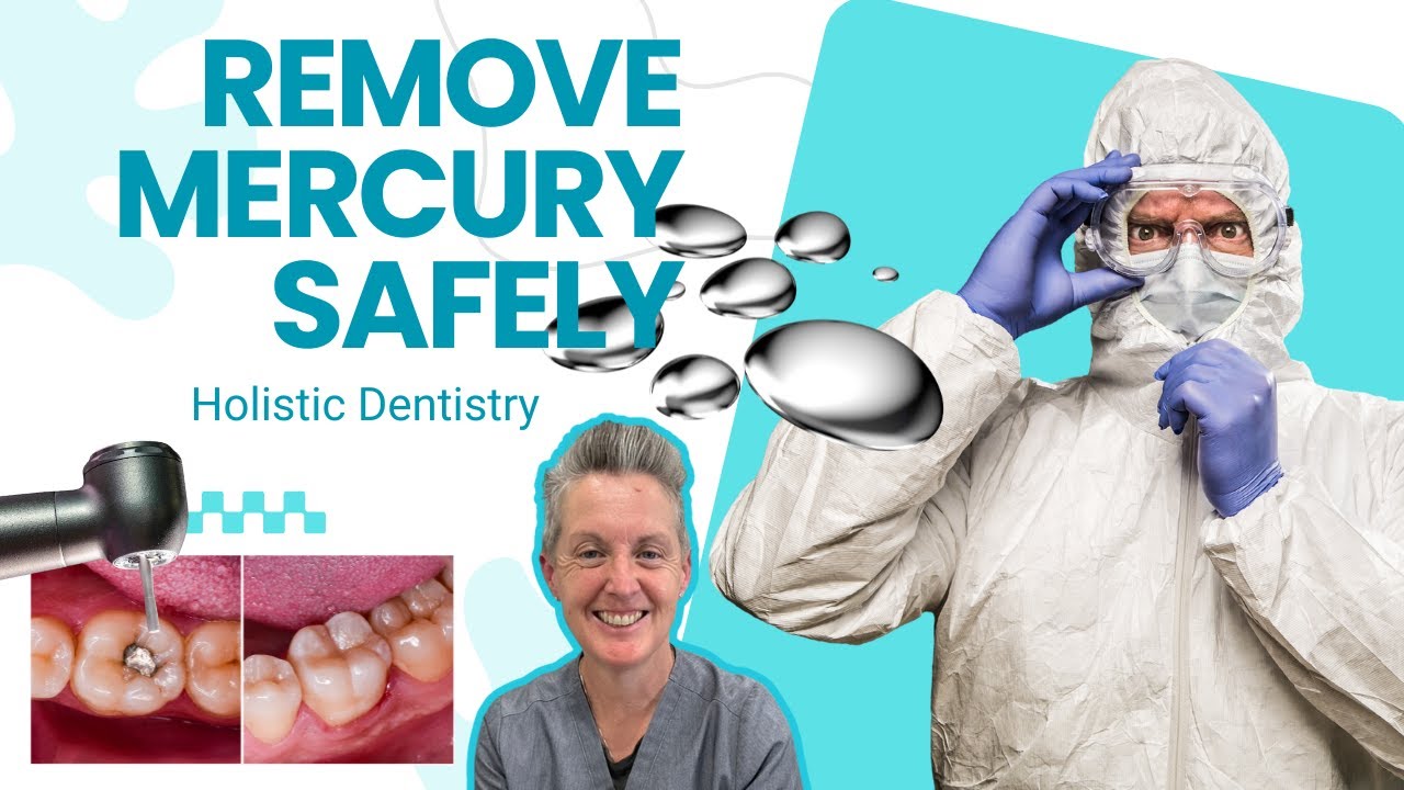 Get those old mercury fillings REMOVED! Truth About Mercury in Your Teeth [Safe Amalgam Replacement]