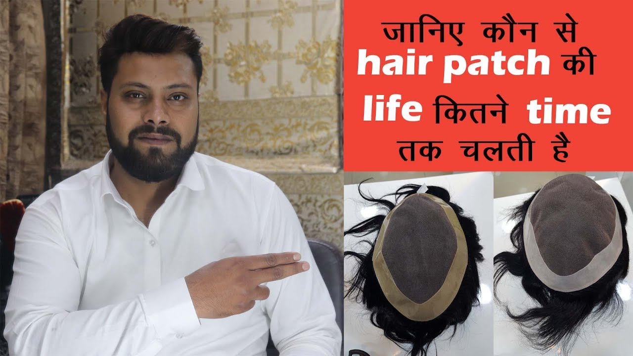 What is the life | of different  patches |  by Abdul Rahman | delhi hair fixing | call us-9873152223