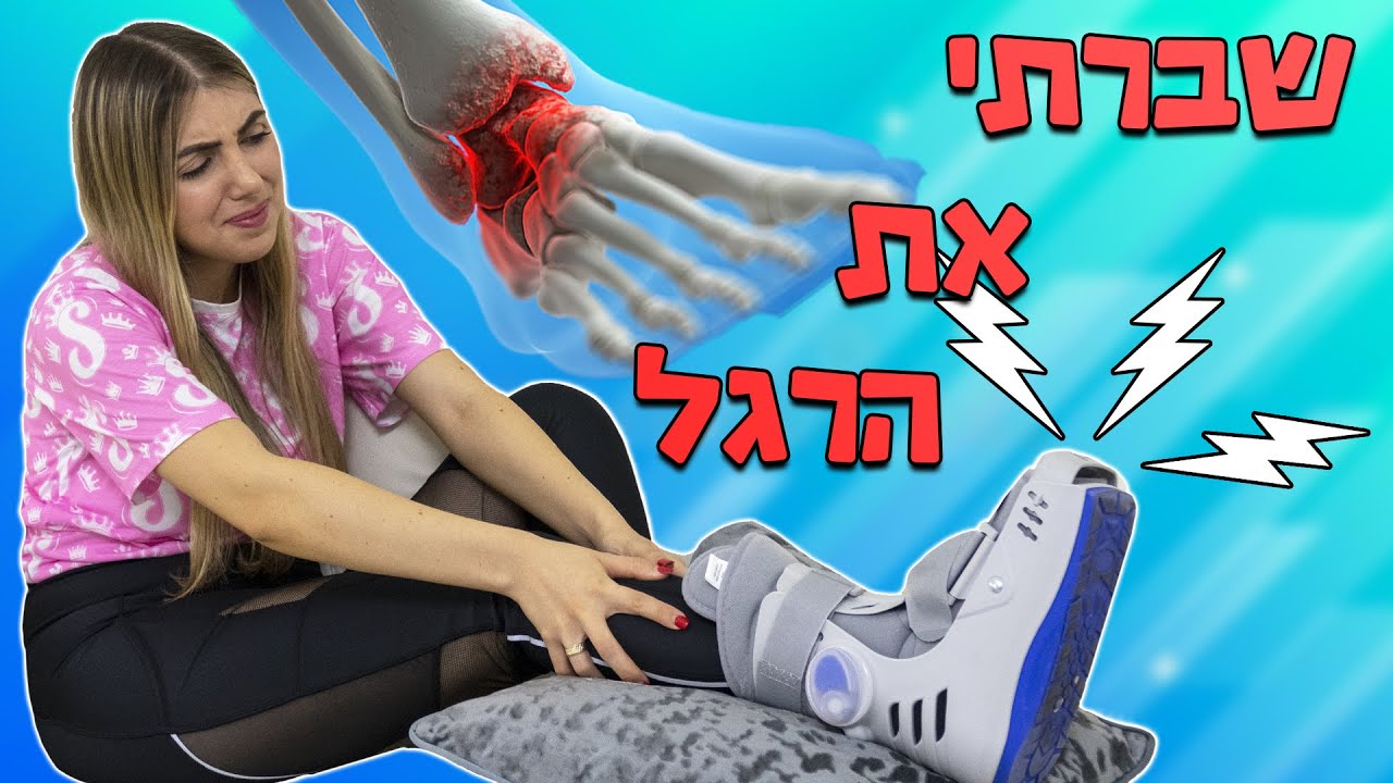 שברתי את הרגל !!!