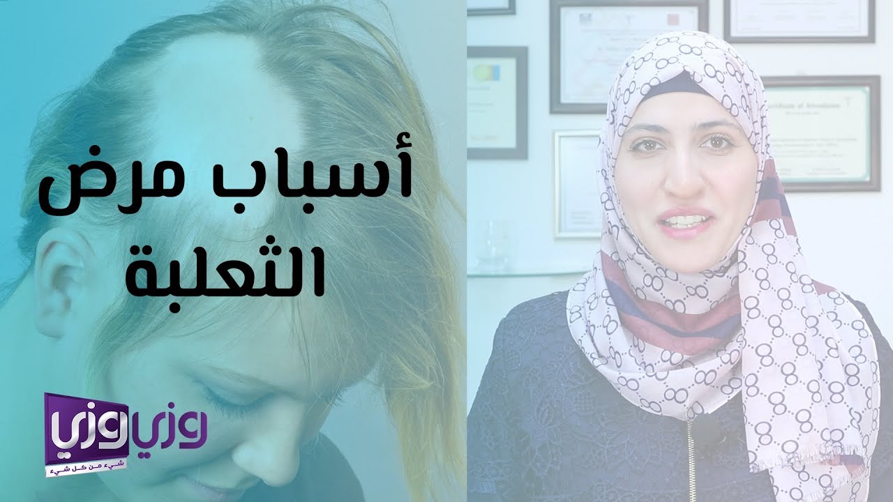 أسباب مرض الثعلبة وعلاجه