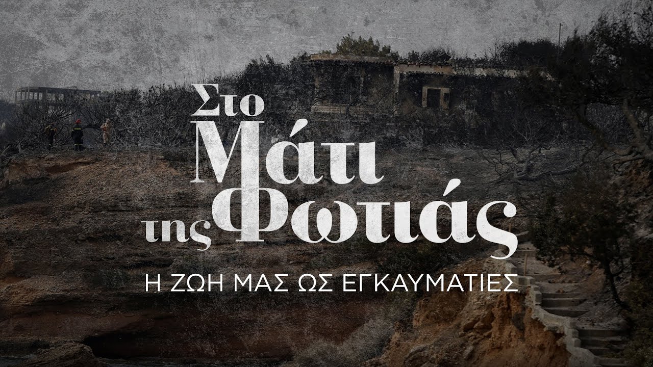 Στο Μάτι της Φωτιάς: Η ζωή μας ως εγκαυματίες