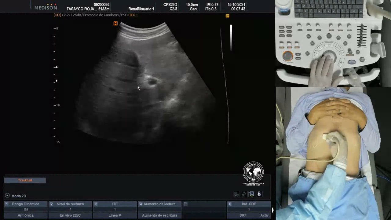 Bb Collaborate  Tema  Practica de Eco Abdomen   8am   12m   Dr  R  Matos   recording 1 2