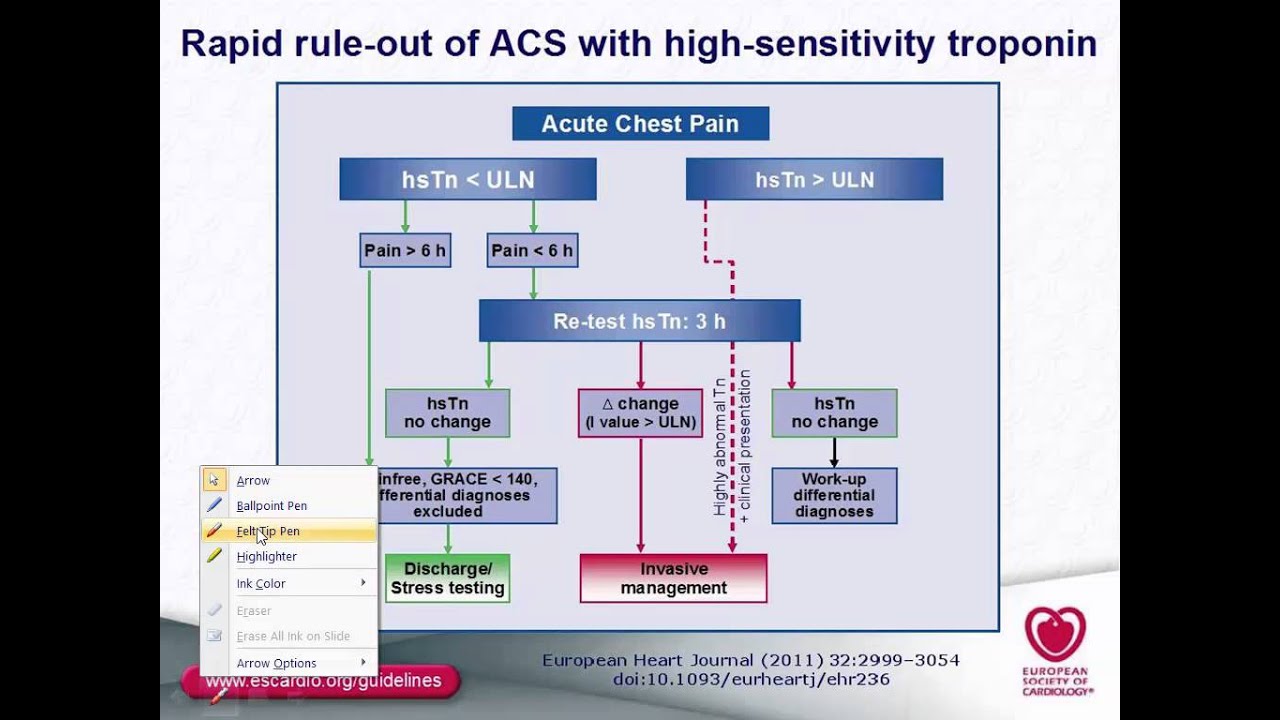 NST-ACS