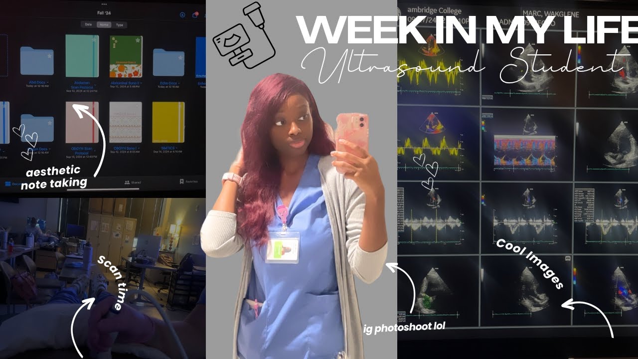 WEEK IN MY LIFE: Ultrasound/Sonography Student Edition