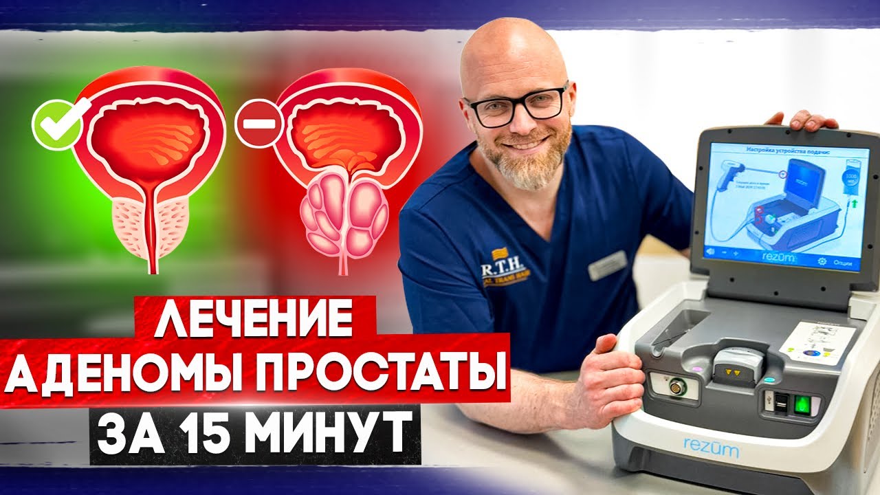 Лечение аденомы простаты за 15 минут! Принцип работы Rezum!