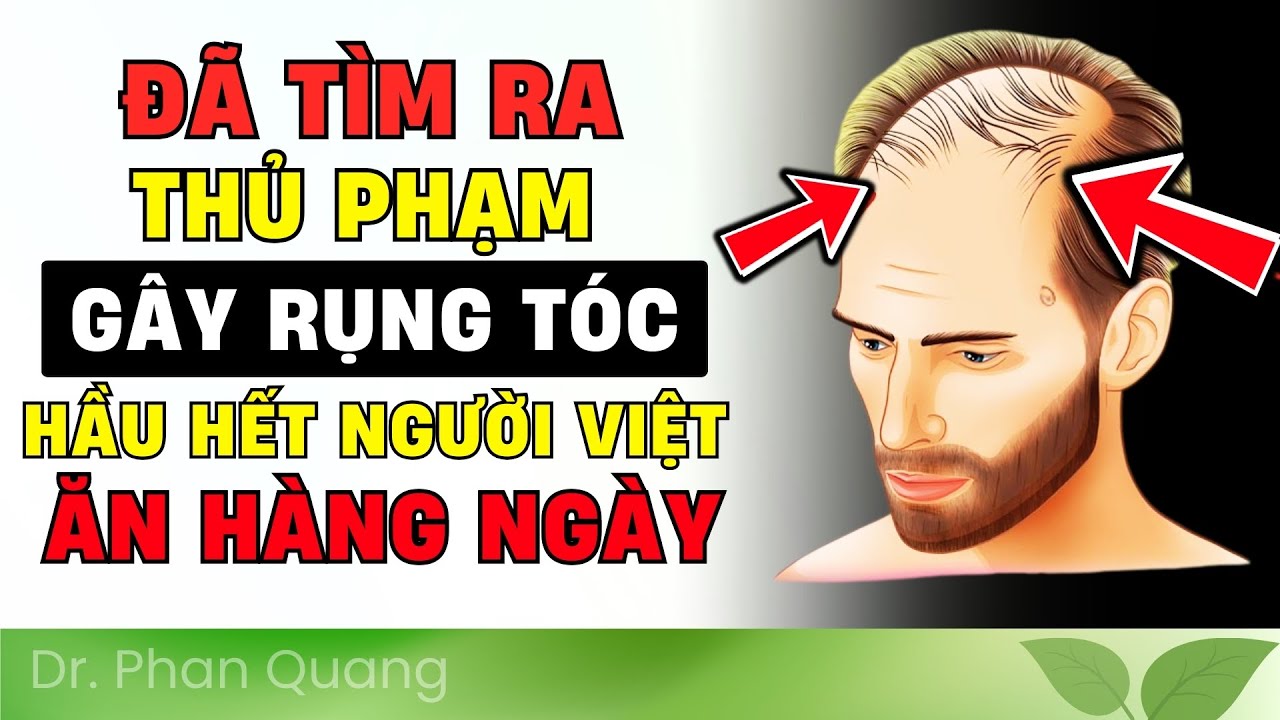 😱 RỤNG TÓC NHIỀU? TRÁNH NGAY 10 THỰC PHẨM 