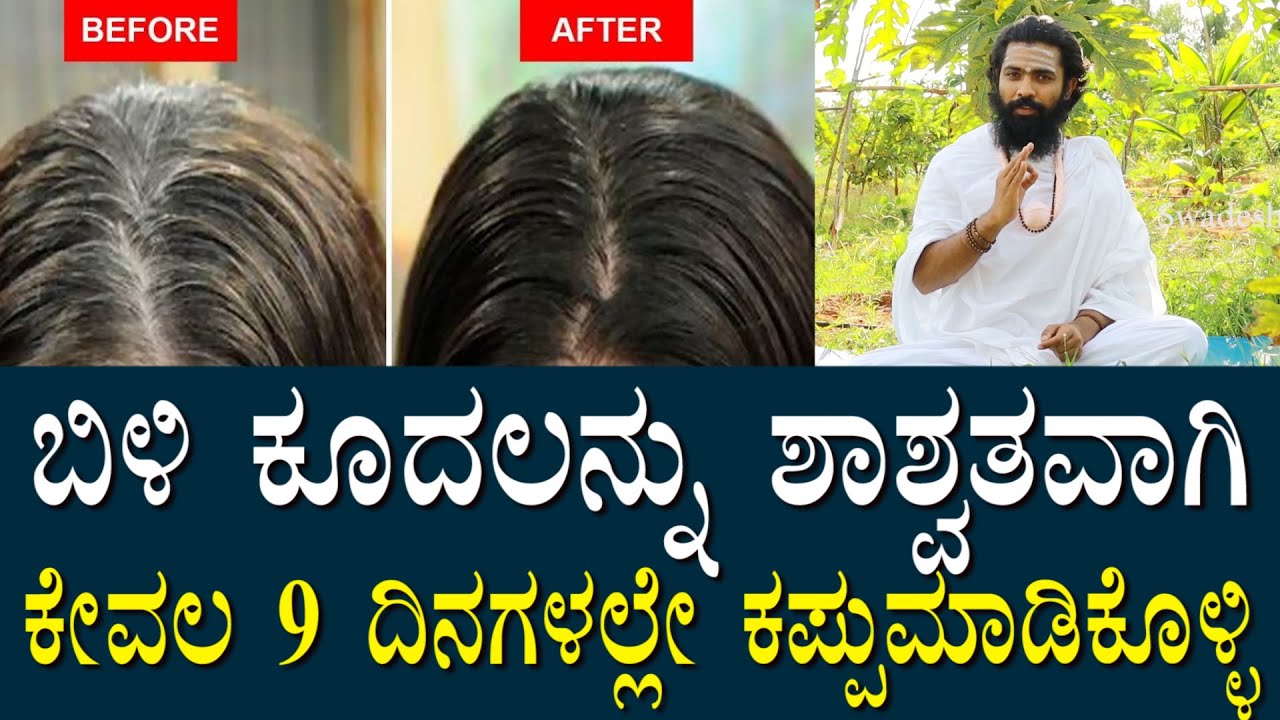 ಕೇವಲ 9 ದಿನಗಳಲ್ಲಿ ಬಿಳಿ ಕೂದಲನ್ನು ಶಾಶ್ವತವಾಗಿ ಕಪ್ಪು ಮಾಡಿಕೊಳ್ಳಿ | Just keep black hair white forever