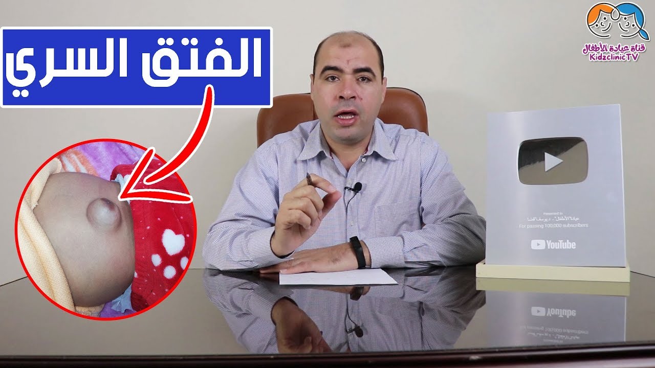 #الفتق السرى عند الرضع ومتي يحتاج الي #الجراحة ؟ hernia repair in a baby